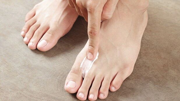 Instrucciones para el uso de la marca de exodermina de la marca Creme contra el hongo para un buen resultado